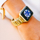 TweeDorbs Prism Straps